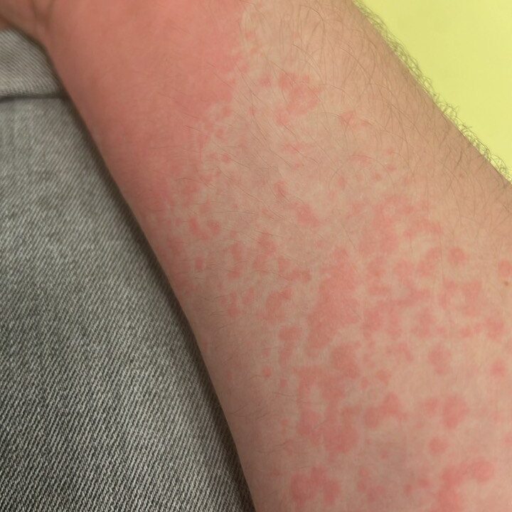 photo 5936135593736124595 y