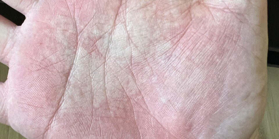 photo_5936135593736124599_y