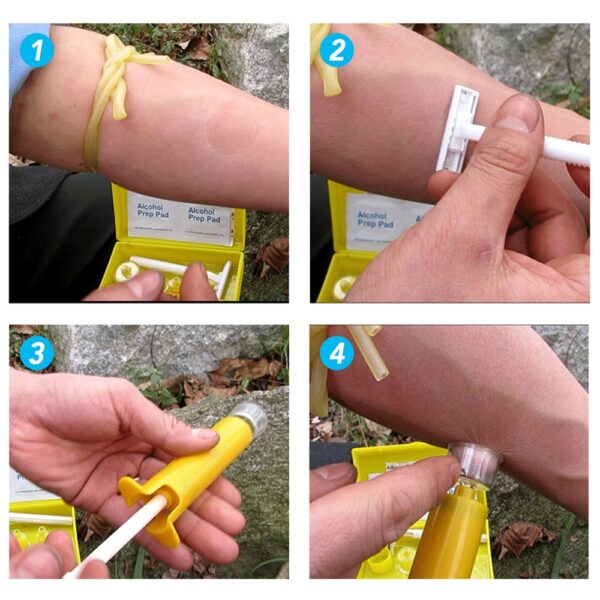Anti-Gift Saugpumpe – Bild 3